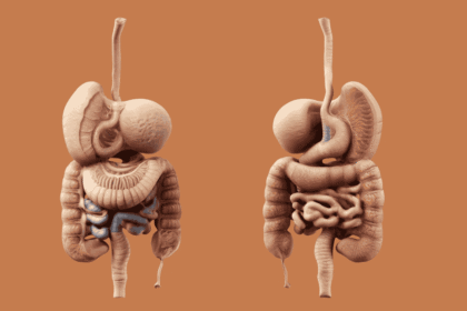 Understanding Gastroshiza: A Complete Guide to This Digestive Condition